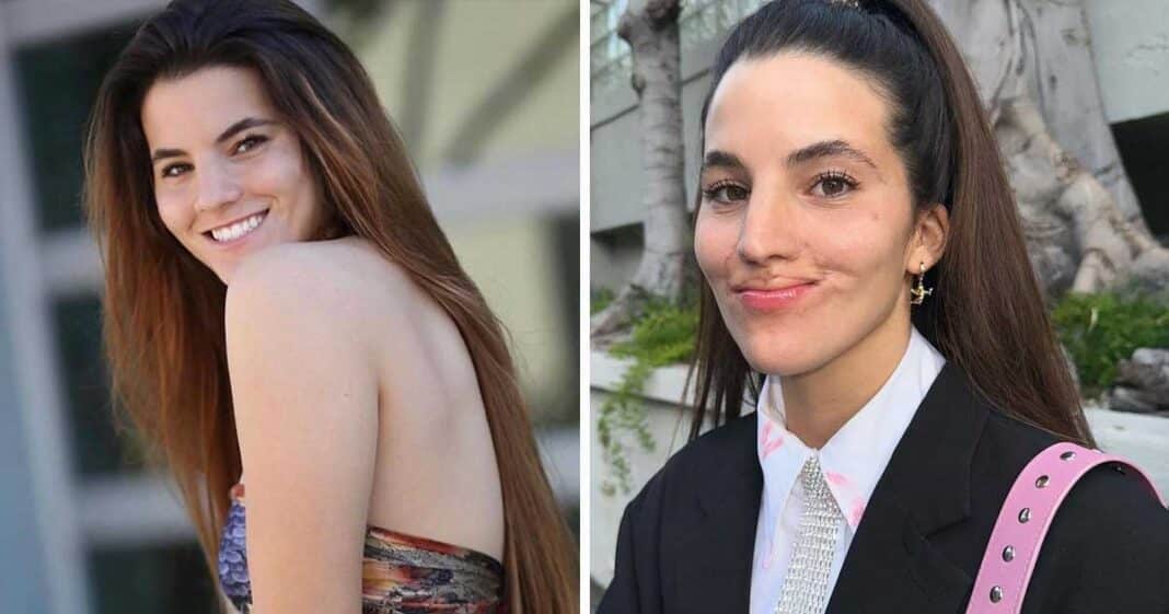 Brooklinn Khoury Shares Before- and-After Photos of Her Smile Since Dog Attack