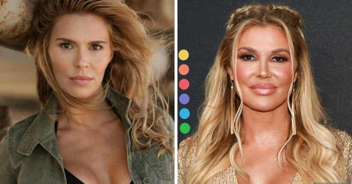 Shocking Before and After Plastic Surgery Transformation of The “Real Housewives” Cast 15 Shocking Before and After Plastic Surgery Transformation of The “Real Housewives” Cast 15
