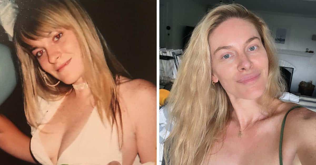 Shocking Before and After Plastic Surgery Transformation of The “Real Housewives” Cast 1 Shocking Before and After Plastic Surgery Transformation of The “Real Housewives” Cast 1