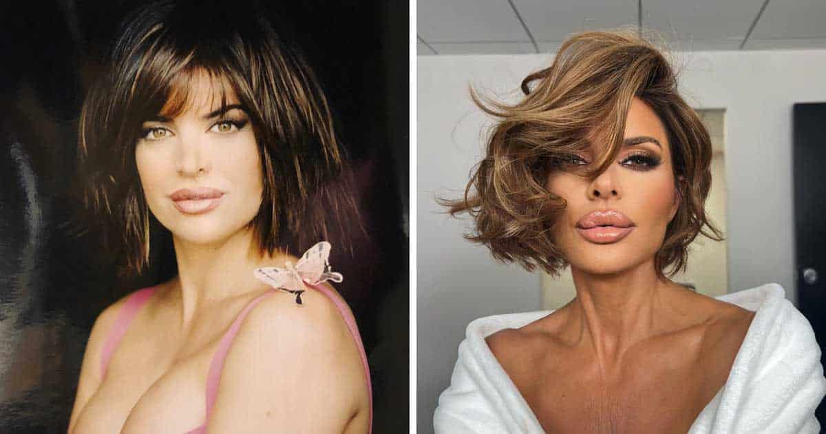 Shocking Before and After Plastic Surgery Transformation of The “Real Housewives” Cast 5 Shocking Before and After Plastic Surgery Transformation of The “Real Housewives” Cast 5