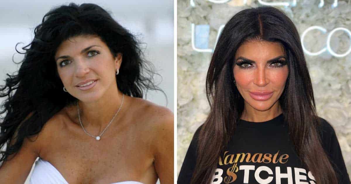 Shocking Before and After Plastic Surgery Transformation of The “Real Housewives” Cast 4 Shocking Before and After Plastic Surgery Transformation of The “Real Housewives” Cast 4